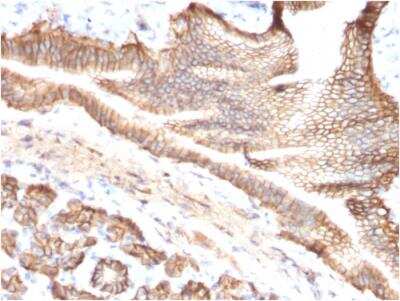 Immunohistochemistry-Paraffin: TROP-2 Antibody (TACSTD2/2151) - Azide and BSA Free [NBP2-75744]
