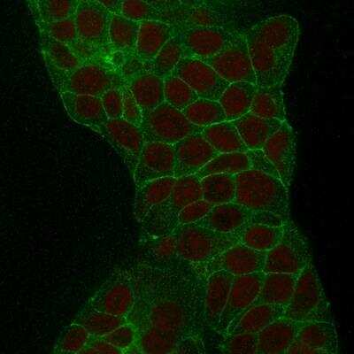 Immunocytochemistry/ Immunofluorescence: TROP-2 Antibody (TACSTD2/2152) - Azide and BSA Free [NBP2-75746]