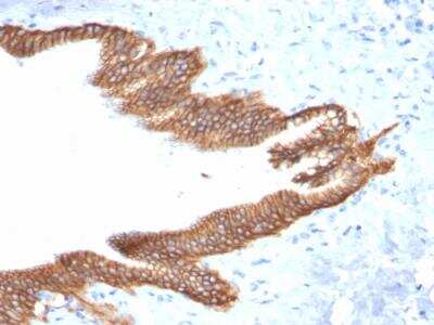 Immunohistochemistry-Paraffin: TROP-2 Antibody (TACSTD2/2152) - Azide and BSA Free [NBP2-75746]