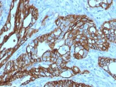 Immunohistochemistry-Paraffin: TROP-2 Antibody (TACSTD2/2152) [NBP2-75745]