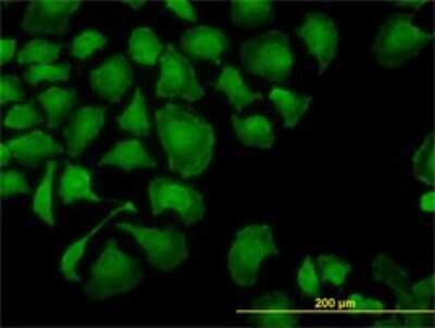 Immunocytochemistry/ Immunofluorescence: TROVE2 Antibody (1F2) [H00006738-M03]