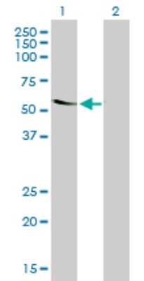 Western Blot: TROVE2 Antibody (1F2) [H00006738-M03]