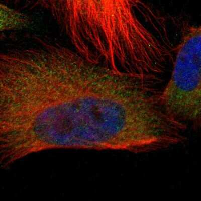 Immunocytochemistry/ Immunofluorescence: TROVE2 Antibody [NBP2-55127]