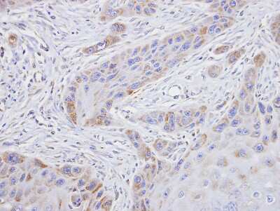 Immunohistochemistry-Paraffin: TROVE2 Antibody [NBP1-32125]