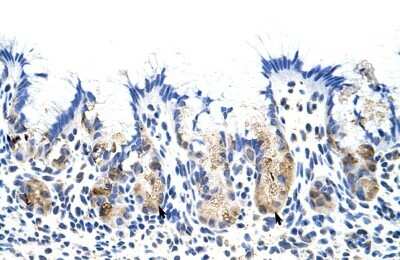 Immunohistochemistry-Paraffin: TROVE2 Antibody [NBP1-57301]