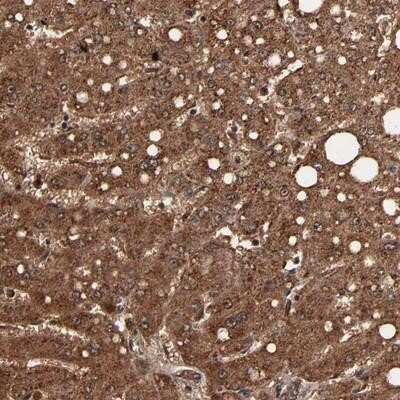 Immunohistochemistry-Paraffin: TROVE2 Antibody [NBP1-86998]