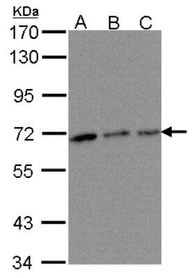 Western Blot: TROVE2 Antibody [NBP1-32125]