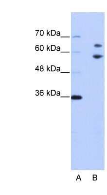 Western Blot: TROVE2 Antibody [NBP1-57301]