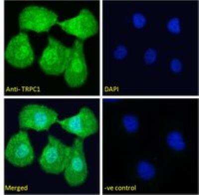 Immunocytochemistry/ Immunofluorescence: TRPC1 Antibody [NBP2-62000]