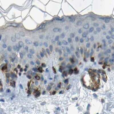 Immunohistochemistry-Paraffin: TRP2 Antibody [NBP1-86892]