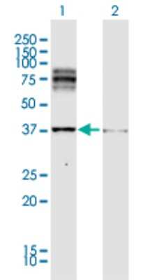 Western Blot: TRP2 Antibody [H00001638-D01P]