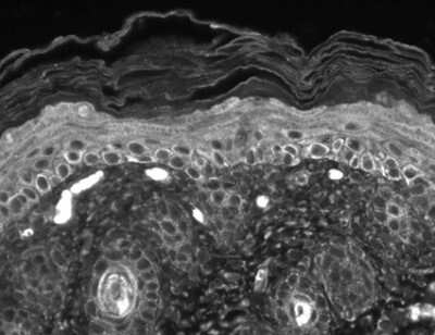 Immunohistochemistry-Paraffin: TRP7 Antibody (N64A/36) [NBP1-48318]