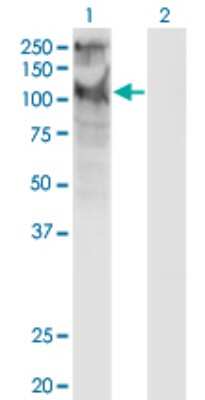 Western Blot: TRPC5 Antibody (1C8) [H00007224-M10]