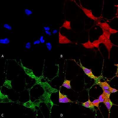 Immunocytochemistry/ Immunofluorescence: TRPC5 Antibody (N67/15) [NBP2-12919]