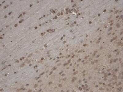 Immunohistochemistry: TRPC5 Antibody (N67/15) [NBP2-12919]