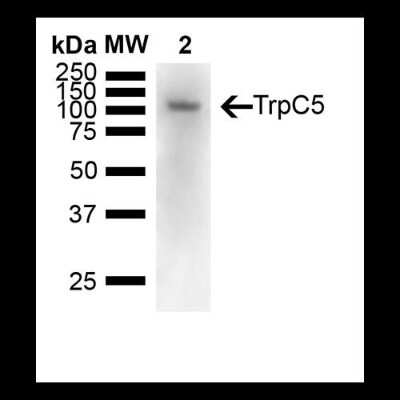 Western Blot: TRPC5 Antibody (N67/15) [NBP2-12919]