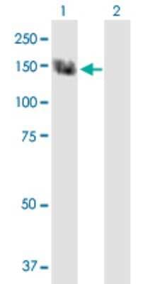 Western Blot: TRPC5 Antibody [H00007224-B01P]