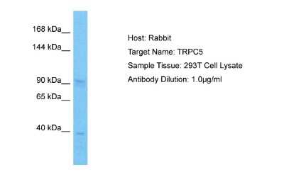 Western Blot: TRPC5 Antibody [NBP2-82363]
