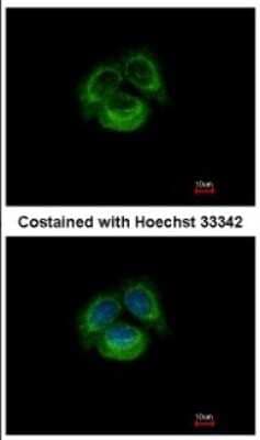 Immunocytochemistry/ Immunofluorescence: TRPC6 Antibody [NBP2-20737]