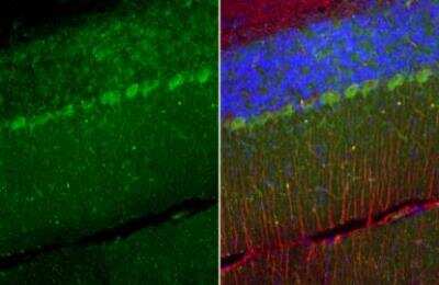 Immunohistochemistry-Paraffin: TRPC6 Antibody [NBP1-31008]
