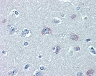 Immunohistochemistry-Paraffin: TRPM2 Antibody [NBP1-59618]