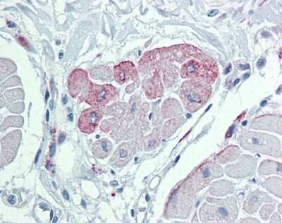 Immunohistochemistry-Paraffin: TRPM2 Antibody [NBP1-59618]