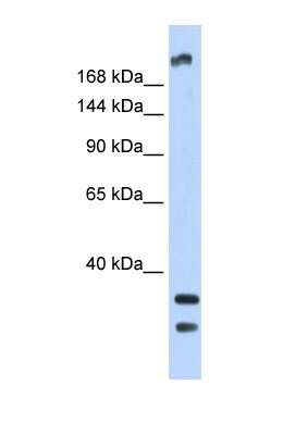 Western Blot: TRPM2 Antibody [NBP1-59618]