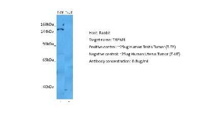 Western Blot: TRPM3 Antibody [NBP2-86876]
