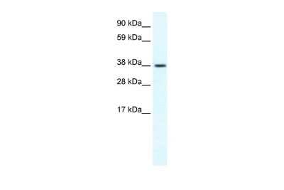 Western Blot: TRPM3 Antibody [NBP2-86877]