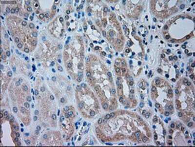 Immunohistochemistry-Paraffin: TRPM4 Antibody (OTI10H5) [NBP1-48036]