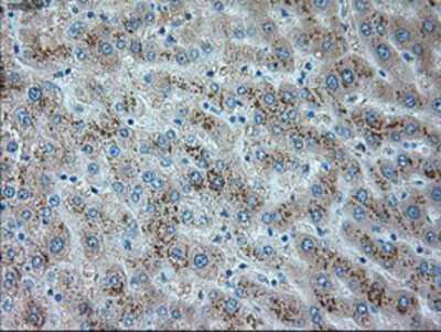 Immunohistochemistry-Paraffin: TRPM4 Antibody (OTI10H5) [NBP1-48036]