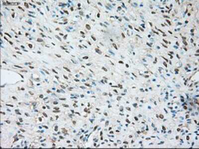 Immunohistochemistry-Paraffin: TRPM4 Antibody (OTI10H5) [NBP1-48036]