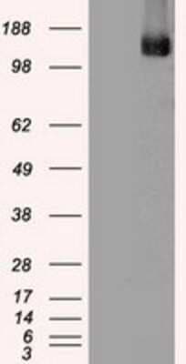 Western Blot: TRPM4 Antibody (OTI10H5) [NBP1-48036]