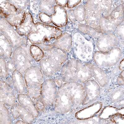 Immunohistochemistry-Paraffin: TRPM4 Antibody (CL11214) [NBP3-07990]