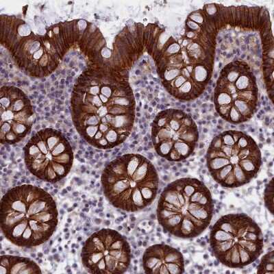 Immunohistochemistry-Paraffin: TRPM4 Antibody [NBP2-13487]