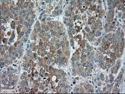 Immunohistochemistry: TRPM4 Antibody (OTI10H5) - Azide and BSA Free [NBP2-74647]