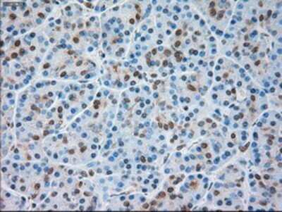 Immunohistochemistry: TRPM4 Antibody (OTI10H5) - Azide and BSA Free [NBP2-74647]