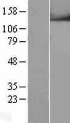 Western Blot: TRPM4 Overexpression Lysate [NBL1-17336]
