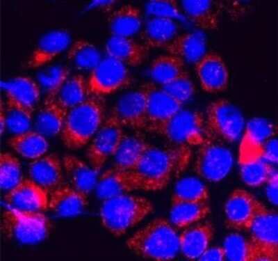 Immunocytochemistry/ Immunofluorescence: TRPM7 Antibody - Azide and BSA Free [NBP1-20224]