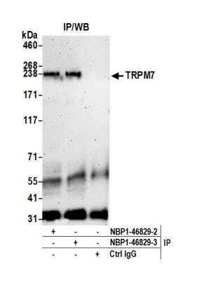 Immunoprecipitation: TRPM7 Antibody [NBP1-46829]