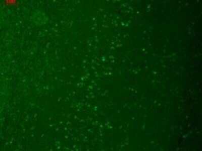 Immunocytochemistry/ Immunofluorescence: TRPM7 Antibody (S74) [NBP2-12906]