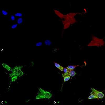 Immunocytochemistry/ Immunofluorescence: TRPM7 Antibody (S74) [NBP2-12906]