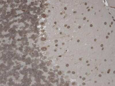 Immunohistochemistry: TRPM7 Antibody (S74) [NBP2-12906]