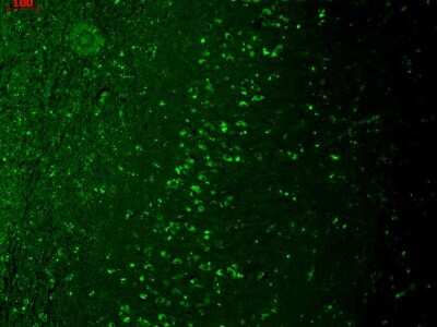 Immunohistochemistry: TRPM7 Antibody (S74) [NBP2-12906]