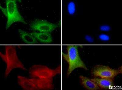 Immunocytochemistry/ Immunofluorescence: TRPM8 Antibody - BSA Free [NBP1-97311]