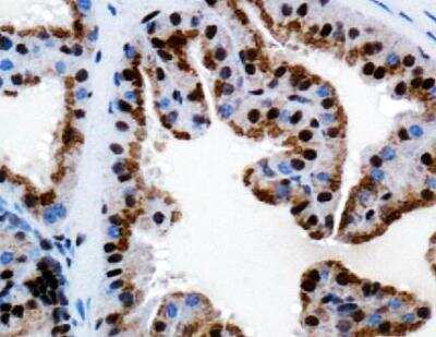 Immunohistochemistry: TRPM8 Antibody - BSA Free [NBP1-97311]