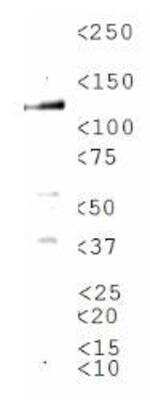 Western Blot: TRPM8 AntibodyBSA Free [NBP1-97311]