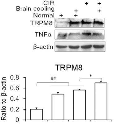 Western Blot: TRPM8 AntibodyBSA Free [NBP1-97311]