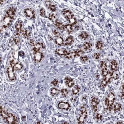 Immunohistochemistry-Paraffin: TRPS1 Antibody [NBP2-62672]