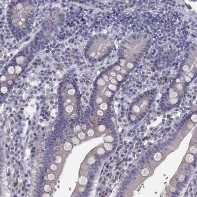 Immunohistochemistry-Paraffin: TRPS1 Antibody [NBP2-62672]